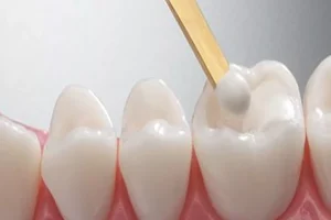 ترمیم دندان